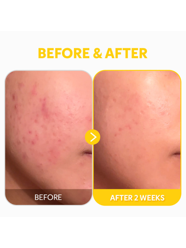 TIRTIR Pure Vitamin C 24 Serum 30ml